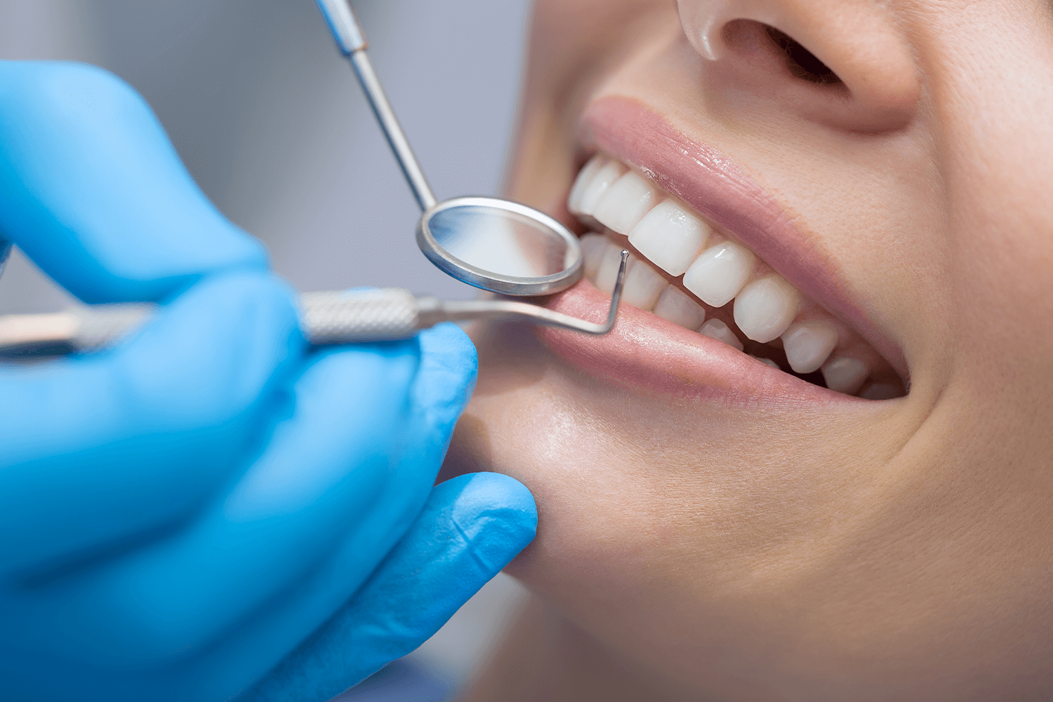 Tratamientos dentales no quirurgicos