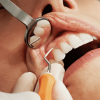 Dentista revisando encias con instrumentos