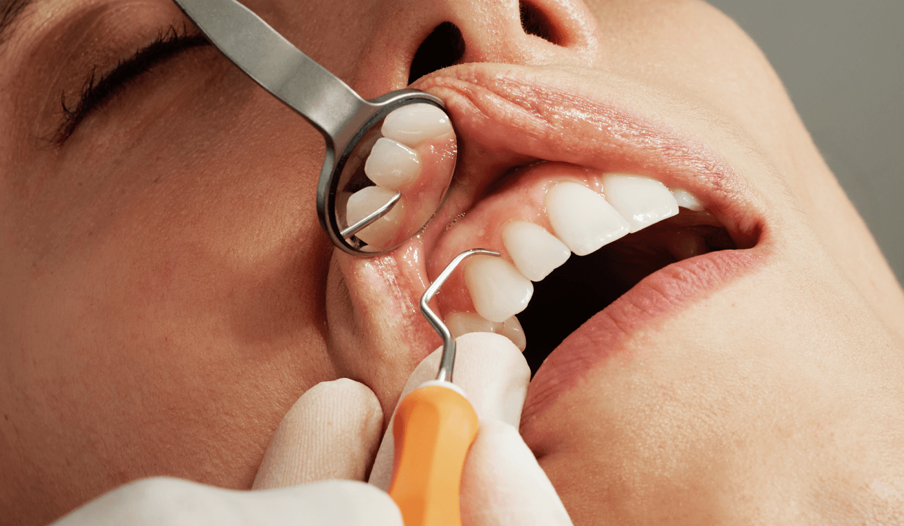 Dentista revisando encias con instrumentos